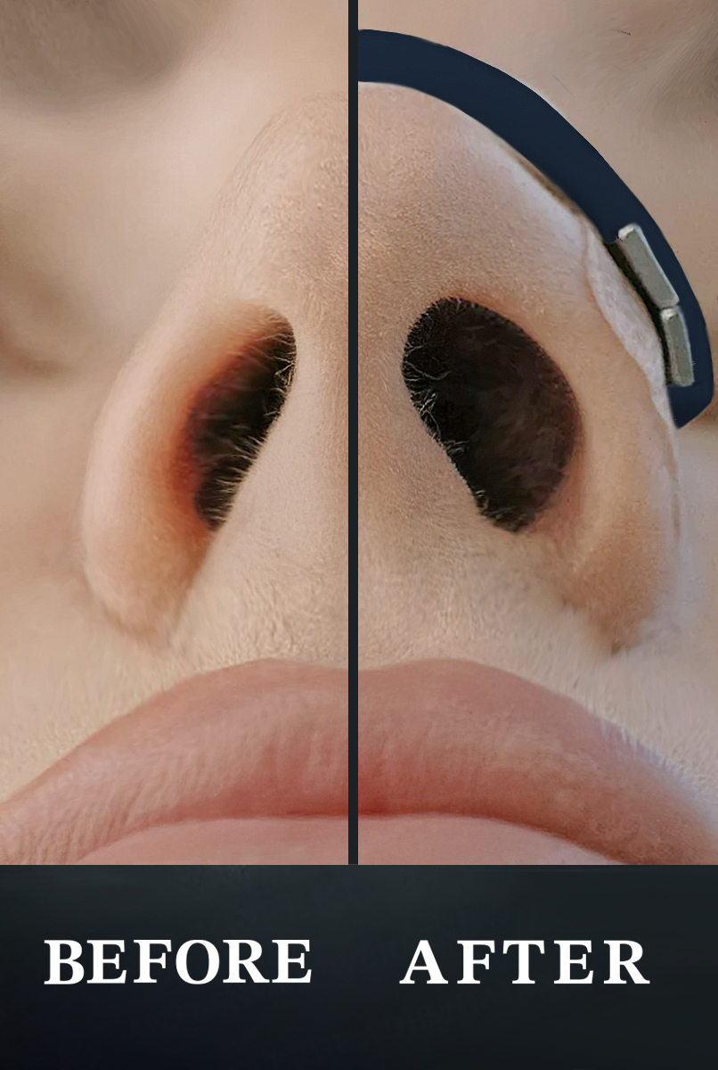 Magnetische Neusstrips Navy Blue